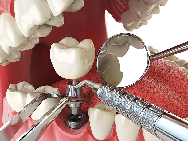 Best Emergency Cosmetic Dentistry in Pinehurst, TX
